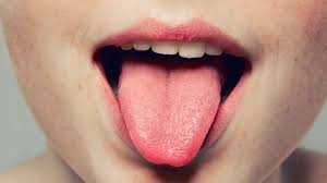 Ulser mulut juga dikenali sebagai serawan, guam, atau mata ikan ini adalah luka pada mukosa mulut. Ada Bintik Kecil Di Lidah Waspadai Masalah Kesehatan Ini