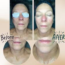 Licensed aesthetician recommendations for facial services