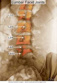 Pin On Back Pain