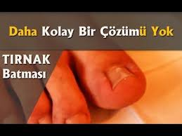 5 Dakikada Tirnak Batmasina Kolay Cozum Youtube Cilt Ipuclari Tirnak Batman