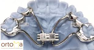 Bu ekipman parçaları bedenin ve zihnin terapi ve rehabilitasyon sürecine yardımcı olur. Ortoma Pracownia Ortodontyczna Ortoma Orthodontic Laboratory About Facebook