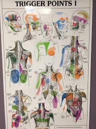 trigger point chart 1 yelp