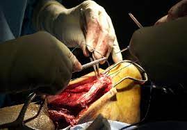 Www Surgeryassistant Nl