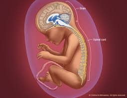 Yeah, that's the rank of backbone tutorial by creativity tuts amongst all backbone.js tutorials recommended by the programming community. Spina Bifida Treatment Midwest Fetal Care Center
