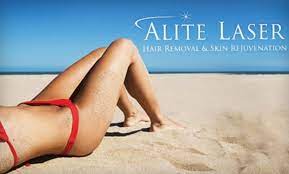 The laser hair removal effectiveness lies in how regularly the procedure can be administered. Up To 71 Off Laser Hair Removal Alite Laser Groupon