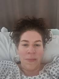 Cryoablation post-procedure experience and effects