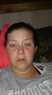 This is to my epilepsy. You got me once again caught me completely off  guard finally one day I could go fellowship with my church family you had  to show up and