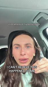 Hilarious iCloud Mistake: Embarrassing Photo Reveal