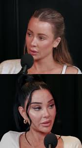 Olivia Attwood Price of Perfection Big Lips