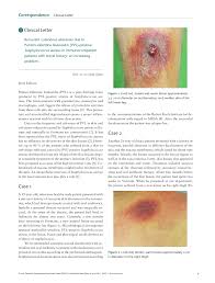 Look for hiv and other causes of immunosuppression Pdf Recurrent Cutaneous Abscesses Due To Panton Valentine Leukocidin Pvl Positive Staphylococcus Aureus In Immunocompetent Patients With Travel History An Increasing Problem