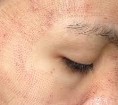 فراكشنال Co2 ليزر تجربتي معه و اضراره جميلة دليل الليزر المنزلي