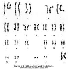 Harvesting cells (usually from a foetus or white blood cells of adults). Student Exploration Human Karyotyping Human Karyotyping Nico Pdf Name Nicole Rodriguez Date Eds Atlas Of Human Chromosome Heteromorphisms Foodbloggermania It