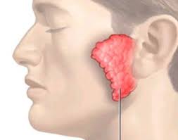 Teo tinh hoàn do mắc bệnh quai bị có thể sinh con được không?