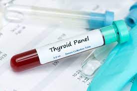 This steep cost of the testing deters many individuals without insurance from getting the blood testing that they need. How Doctors Diagnose Hypothyroidism Diagnosis Of An Underactive Thyroid Function Is Made Based On A Combination Of Thyroid Blood Test Results Symptoms And Several Other Factors