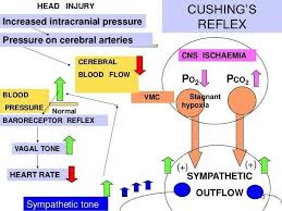 Image result for Cushing Response