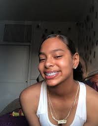 Business And Promotions Alldayslayy Cute Braces Light Skin Girls Braces Girls