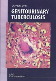 Image result for Genitourinary Tuberculosis