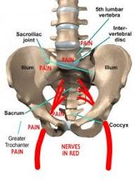 Even Though Your Si Joints Are Small They Re Actually Very Strong Because They Help Distribute Weight Sacroiliac Joint Dysfunction Sacroiliac Joint Sacroiliac