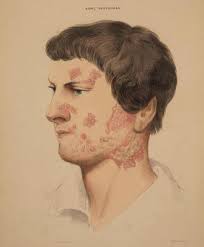 Breaking Boundaries: Working Class Skin