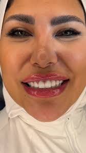 Zirconia Teeth Solutions at Hourani Dental Clinic