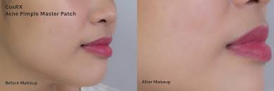 When you see a head emerging on your pimple. Can You Really Wear Acne Patches Under Makeup We Test Six Types To Find Out The Best Project Vanity
