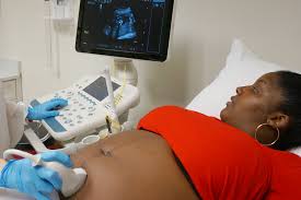 Free transitional emergency housing for pregnant women. Services Her Choice Birmingham
