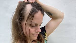 Pludselig tabte Helene alt håret