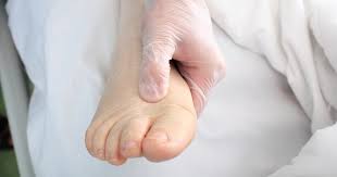 hamilelikte ayak ve bilek sismesi odem nasil onlenir hamilelik haberleri