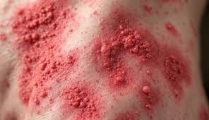 Image result for Erythrococca atrovirens