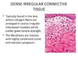 Dense Irregular Connective Tissue Biology Notes Tissue Collagen Fibers
