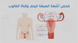 فحص أشعة الصبغة للرحم وقناة الفالوب youtube