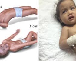 Pembekal buah & sayur premium quality. Khasiat Dan Kebaikan Air Rebusan Serai Dan Halia Yang Ramai Tak Tahu Sangat Berkesan Mengubati Pelbagai Penyakit My Info Maya