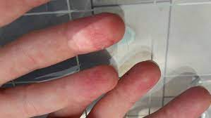 Hatte Das Jemand Schon Mal Und Weiss Was Das Sein Konnte Gesundheit Finger