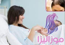 علاج تساقط الشعر بعد الولادة خلال ايام