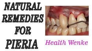 Natural Remedies For Pieria Best Natural Remedies For Pieria Bleeding Gums Youtube