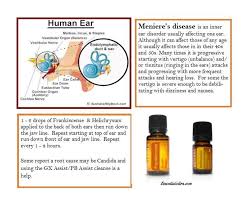 Image Result For Doterra Vertigo Doterra Vertigo Human Ear