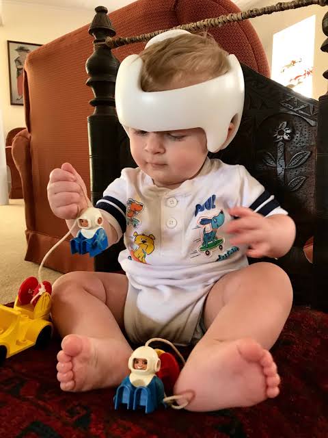 Cranial Helmet لماذا تحتاج خوذة تصحيح شكل الرأس إلى تعديلات متكررة؟ 10 أسباب مهمة يجب أن يعرفها كل أب وأم