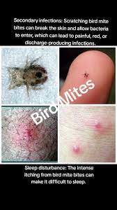 Image result for mite bites on humans