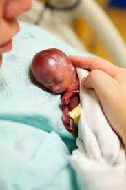 Image result for delivery baby