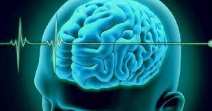 Se requieren pruebas de esa irreversibilidad. Muerte Cerebral Tema En Debate Continuo Portalgeriatrico
