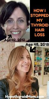 10 Things That Stopped My Thyroid Hair Loss Hypothyroid Mom Thyroid Hair Loss Thyroid Hair Hair Loss Remedies