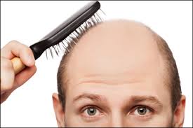One of the most effective ways of dealing with hair loss is. Herbal Remedies For Hair Loss Ayurvedic Treatment Causes Symptoms