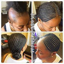 Great Work Alopecia Hairstyles Feed In Braid Hair Styles
