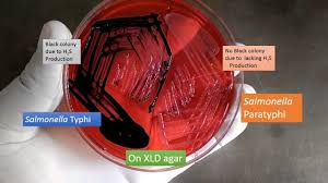 Salmonella Introduction Pathogenesis Lab Diagnosis And Treatment