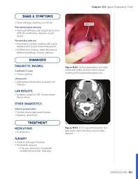 They can look up your nose with a tool called a nasal endoscope to see for sure. Nasal Polyps Osmosis