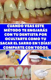 Pin On Dientes