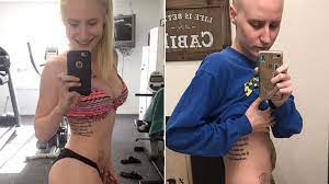 Check spelling or type a new query. Fitness Blogger Shows What Cancer Looks Like On Instagram