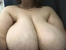 Макромастия 74 фото - скачать порно онлайн