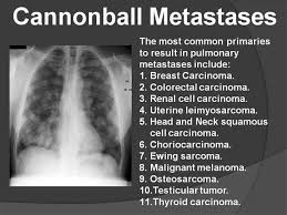Pin By Suma On Radiology Signs Medical Radiography Medical Knowledge Medical Studies