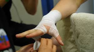 A boxer's fracture is the break of the 5th metacarpal bones of the hand near the knuckle. What Is Boxer S Fracture Symptoms Causes And Treatment Dr Seeds